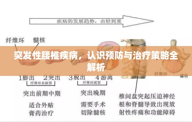 突发性腰椎疾病,认识预防与治疗策略全解析